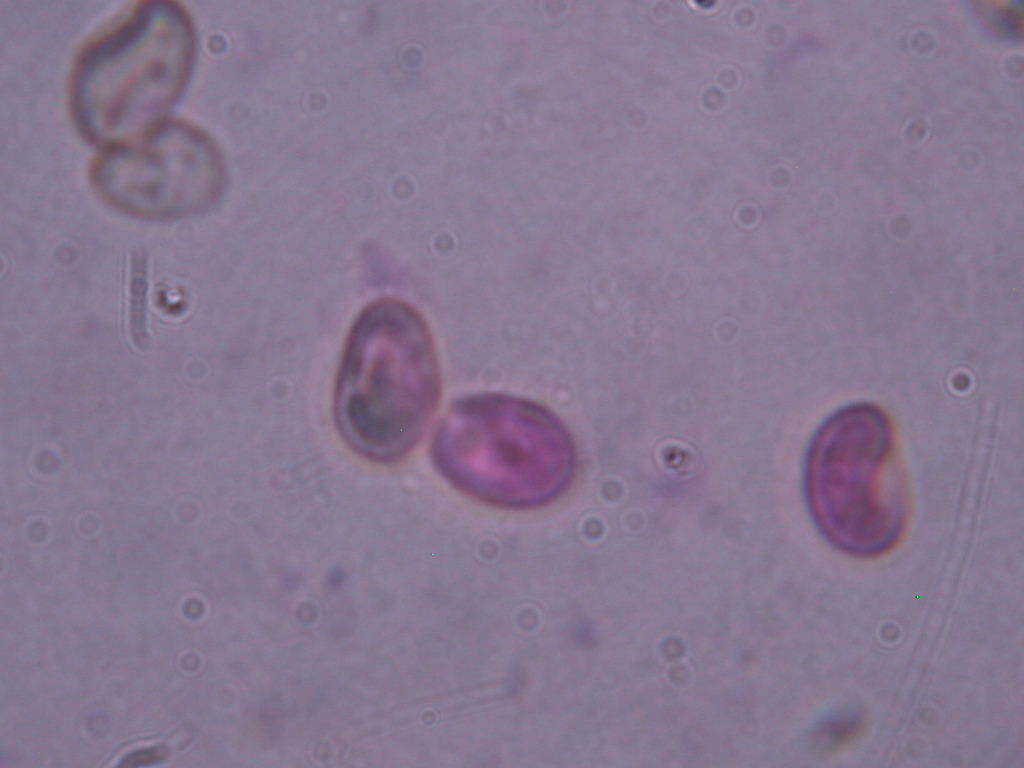 O l''uno... o l''atro???